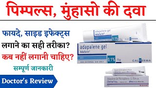 Adapalene Gel Uses Side Effects Review in Hindi  How to Apply Adapalene Gel  Pimples Ki Cream [upl. by Haras169]