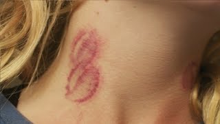 how to give someone a hickey in 2 minutes easy [upl. by Haniraz]