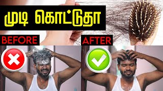 Hair Fall solution  இந்த தப்பெல்லாம் பண்றீங்களா tips for hair growth  How to Wash Hair Correctly [upl. by Damon985]