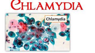 Chlamydia [upl. by Metcalf]