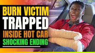 Foster Parent Leaves Black Burn Victim In Hot Car Then This Happens [upl. by Ateval79]