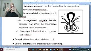 Hernia in Arabic 7  Strangulated Hernia  part 2   by DrWahdan [upl. by Rame]