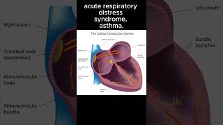 Hyperventilation differentials [upl. by Ahsyia]