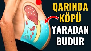 Qarındakı Köp Probleminin Çarəsi  Xalq Təbabətində Müalicəsi [upl. by Carine]