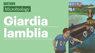 Giardia lamblia Lesson Transmission amp Treatment Full Lesson  Sketchy Medical  USMLE Step 1 [upl. by Capp]