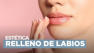 Relleno de labios con ácido hialurónico [upl. by Nyloc]