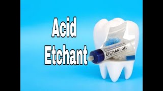 Acid etchant  acid etching  phosphoric acid  Dental Maestro  Dr Jyoti Agarwal [upl. by Anairb]