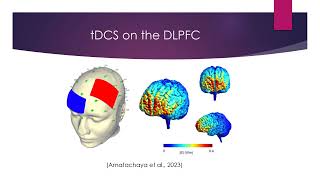 Transcranial Direct Current Stimulation tDCS in Autism Spectrum Disorder ASD [upl. by Arimaj]