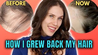 10 Best amp Worst Hair Growth Treatments That I’ve Tried At Home [upl. by Aitsirhc757]