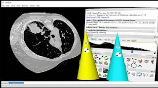 ChimeraX DICOM VR viewer [upl. by Tavish]