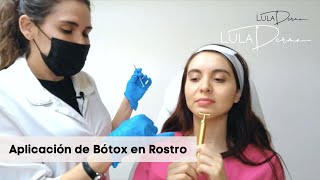 Aplicación de Bótox Toxina Botulínica [upl. by Inahet]