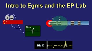 Intro to Intracardiac Electrograms amp the EP Lab [upl. by Levitt]