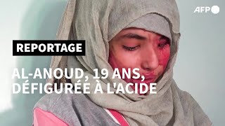 Défigurée à lacide AlAnoud 19 ans visage des femmes brutalisées au Yémen  AFP [upl. by Nnayllas]