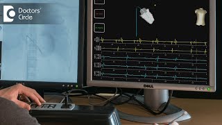 How is electrophysiology study done  Dr Mohammed Haroon Rashid [upl. by Methuselah]