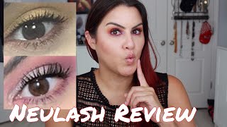 Neulash Review with Before and After [upl. by Noivaz]