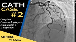 Cath Case 2 Angiography amp Angioplasty  Interpretation and Management [upl. by Sibelle]