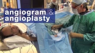 Angiogram amp angioplasty what to expect [upl. by Cross297]