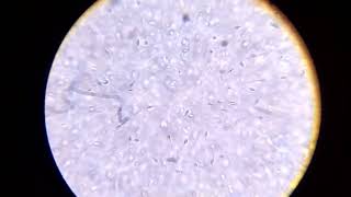 Sperm under the microscope [upl. by Angelico]