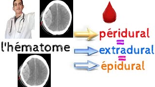 lhématome péridural extradural épidural [upl. by Avraham]