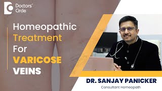 Get Rid of Varicose Veins with Homeopathic Remedies homeopathy DrSanjay Panicker Doctors Circle [upl. by Hanonew961]