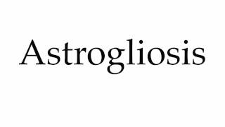 How to Pronounce Astrogliosis [upl. by Hsirahc990]