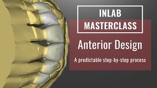 InLab 18 Anterior Design Tips amp Tricks [upl. by Politi639]