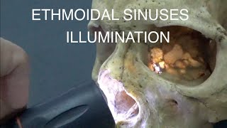 ETHMOIDAL SINUSES  ILLUMINATION [upl. by Trbor955]