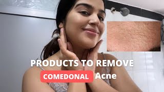 Products to remove Comedonal Acne  Skincare products to remove Whiteheads acne [upl. by Eiznik136]