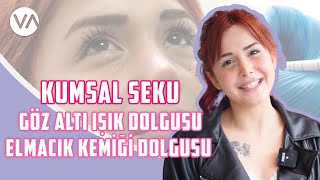 CoolVlog439 I Göz altı Işık Dolgusu ve Elmacık Kemiği Dolgusu I VanityEstetik Shorts [upl. by Matta]