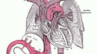 Why does Aortic Rupture cause so many deaths [upl. by Robinette844]