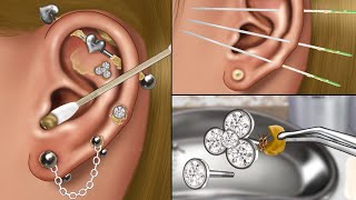 ASMR Piercing Cleaning Animation👂 Blackhead Removing Pus from Piercing Ear Infection Treatment [upl. by Rehpinnej261]