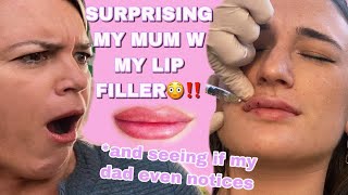 lip filler vlog mums reaction [upl. by Cuhp]