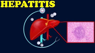 ¿QUÉ ES LA HEPATITIS A B C D E  HEPATITIS AUTOINMUNE [upl. by Hosbein]