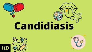 CANDIDIASIS Causes Signs and Symptoms Diagnosis and Treatment [upl. by Buderus275]