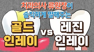 골드 vs 레진인레이 치과의사가 솔직하게 이야기해 드립니다 [upl. by Libna]