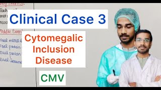 Clinical Case 3  Cytomegalic Inclusion Disease  CMV [upl. by Iasi]