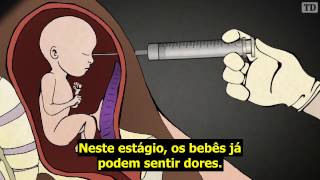 Como é realizado o aborto induzido no terceiro trimestre [upl. by Auhesoj]