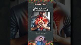 What is Angina Angina Pectoris [upl. by Meredi]