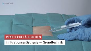 Infiltrationsanästhesie – Grundtechnik  Praktische Fähigkeiten  AMBOSS [upl. by Eecats]