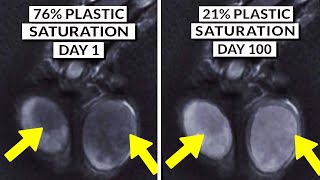 We Finally Know How To Detox Microplastics From The Body [upl. by Moonier866]