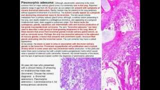 Pulmonary pathology 101Neoplastic diseases of the lung and pleura and tranplantation pathologymov [upl. by Josephine]