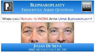 Upper Blepharoplasty Recovery Returning to Work after Upper Eyelid Lift Surgery [upl. by Jovitta]