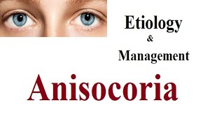 Anisocoria Etiology investigation and management [upl. by Eahc]