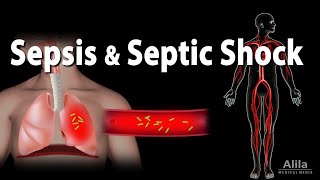 Sepsis and Septic Shock Animation [upl. by Anetta]