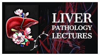 LIVER PATHOLOGY lecture 23 HEPATOCELLULAR CARCINOMA with all important stuff [upl. by Jania]