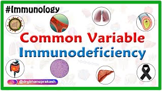 Common variable immunodeficiency CVID USMLE Step 1 [upl. by Swann]