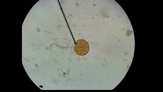 Ascaris lumbricoides hatching of egg [upl. by Haral]