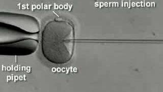 IVF amp ICSI brief overview [upl. by Eyahsal551]