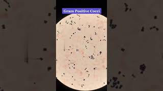 Bacteria 🦠🧫 gram positive cocci and gram negative rod 💙❤️ shorts shortsfeed microbiology [upl. by Chao]