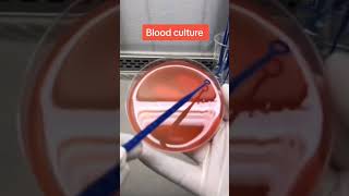 Blood culture and sensitivity test microbiologymicrobiologist laboratory phd microbiologylab [upl. by Adlesirk]